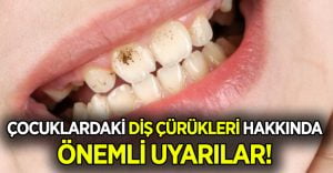 Doktor Akdemir, çocuklardaki diş çürükleri konusunda uyardı