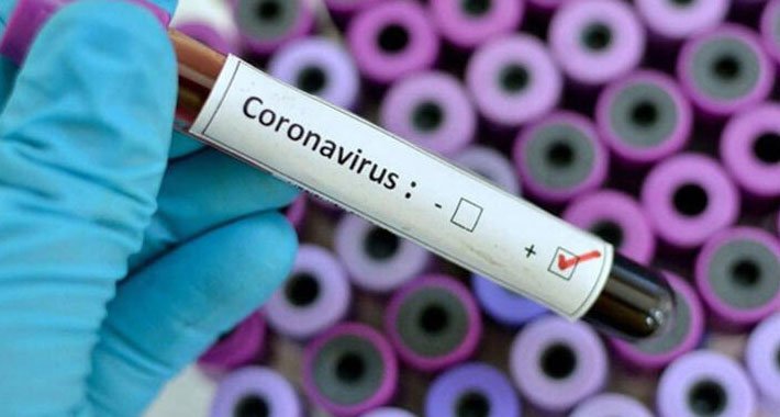 Koronavirüs testi Denizli’de