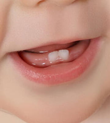 Bebeklerde Diş Çıkarma Belirtileri Farklı Olabilir