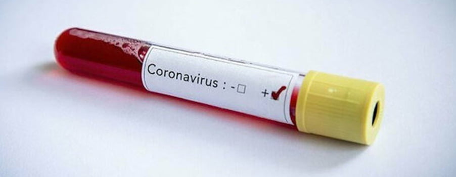 Acıpayam’da koronavirüs can aldı