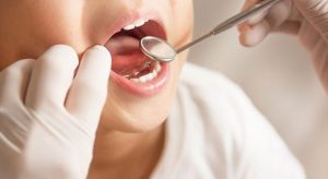 Flor diş çürüklerini yüzde 20 ile 40 arasında engelliyor